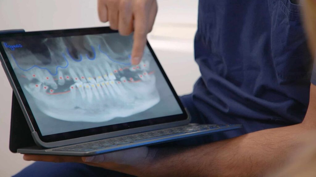 doctor talks a patient through all on four dental implants in liverpool clinic