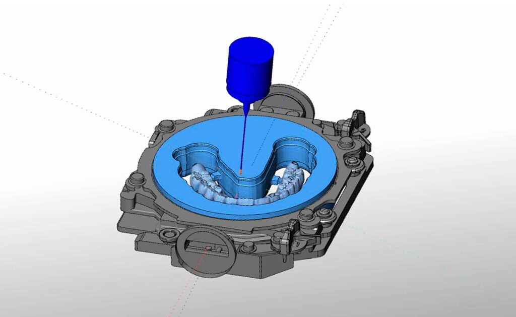 manufacturing the prosthesis