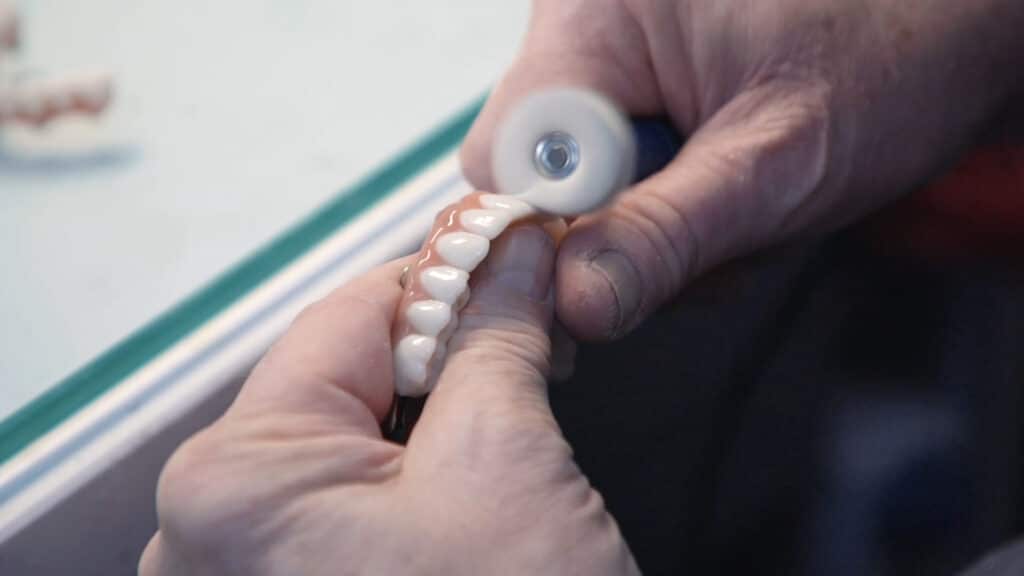 Full Mouth Dental Implants