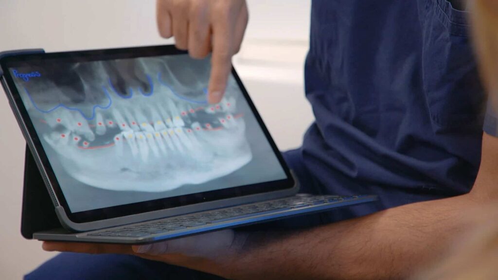 dental implants edinburgh dentist showing patient x ray on laptop